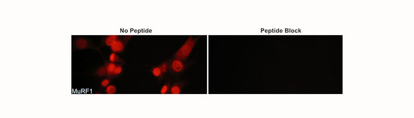 Atrogin-1 and MuRF1: Excellent markers of skeletal muscle atrophy