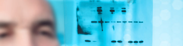 Antibodies That DO NOT WORK in Western Blots