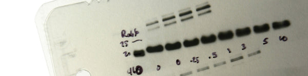 5 Tech Tips For An Easier Western Blot Experience