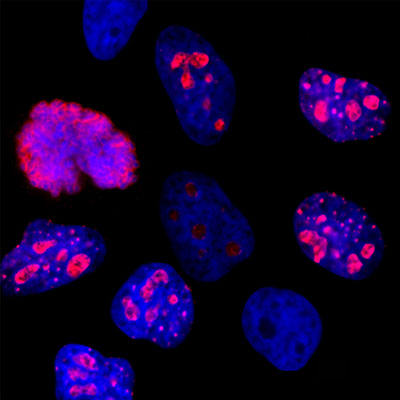 Immunostaining of HeLa cells showing specific labeling of Ki-67 in the nucleoli of rapidly dividing cells, (1:2000) in red.  DNA is stained blue. 