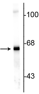 Western blot of rat cortex lysate showing specific immunolabeling of the ~ 66 kDa alpha internexin protein.