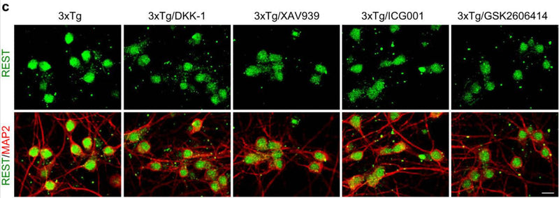 Immunolabeling of REST (green) and neuron marker MAP2 (cat. 1099-MAP2; red) in 3xTg primary cortical neurons (PCNs) shows nuclear REST in neurons treated with vehicle and decreased nuclear REST in 3xTg neurons after a 24-h treatment with the Wnt/β-catenin inhibitors Dickkopf 1 (DKK1), XAV939 and ICG001, or the PERK inhibitor GSK2606414. Image from publication CC-BY-4.0. PMID: 37919281