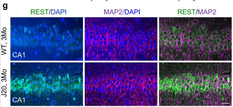 Immunolabeling of REST (green), the neuron marker MAP2 (cat. 1099-MAP2; magenta) and nuclei (DAPI, blue) in the CA1 region of the hippocampus, shows elevated nuclear REST levels in 3-month-old J20 mice. Image from publication CC-BY-4.0. PMID: 37919281