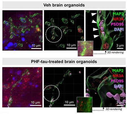 Representative 3D view images of paired helical filament (PHF)-tau-treated human brain organoid fractions. The organoids were labeled for MAP2 (Cat no 1100-MAP2, 1:1000, green), NR3A (red), PSD95 (magenta), and DAPI (blue). White arrows show the positions colocalized between PSD95 and NR3A. The dotted circles show the magnified positions. Scale bar = 10 or 3 μm. Image from publication, CC-BY-4.0. PMID: 39396906 