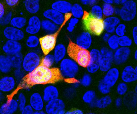 Immunostaining of HEK293 cells transfected with mCherry(red) and stained with anti-mCherry antibody (cat. 1203-mCherry, green, 1:500) subsequently appear yellow. The nuclei stained blue (DAPI) distinguishes untransfected cells.