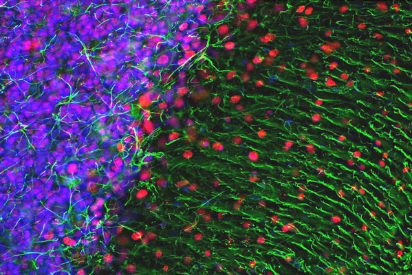 Immunofluorescence of a section of rat cerebellum labeled with anti-MeCP2 (cat. 1205-MECP2, 1:500, red), colabeled with anti-GFAP (cat. 620-GFAP, 1:5000, green), and DAPI staining of nuclear DNA. The anti-GFAP labels the astrocytic cells and the processes of Bergmann glia in the molecular layer.