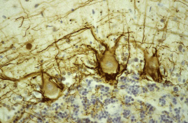 Immunostaining of human cerebellar cortex showing labeling of NF-H (cat. 1450-NFH, DAB, 1:500) in basket cell axons surrounding the large Purkinje neurons. Cerebellar granule cell layer is at the bottom of the image and the molecular layer at the top. Section was counterstained with Hematoxylin.