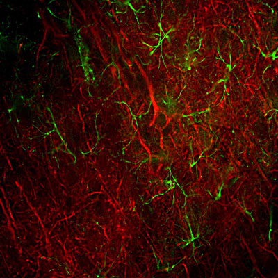 Immunofluorescence of a section of rat frontal cortex showing labeling of Neurofilament-L (cat. 1452-NFL, 1:500, red) and labeling of GFAP (cat. 621-GFAP, 1:5000, green). The anti-NFL antibody labels cell bodies and processes of pyramidal neurons, as well as dendrites and axons of other neuronal cells. While the anti-GFAP antibody labels the network of glial cells. 