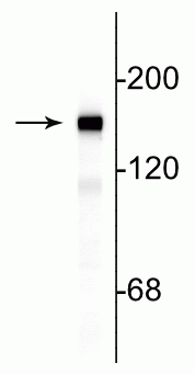 Western blot of rat cortical lysate showing specific immunolabeling of the ~145 kDa NF-M protein.