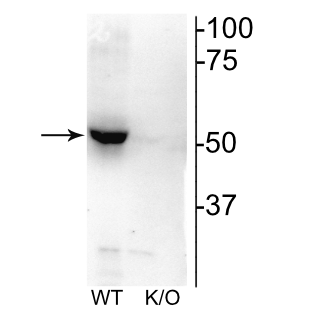 Western blot of mouse habenula lysate showing specific immunolabeling of the ~52 kDa nAChRβ2 protein. 