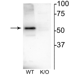 Western blot of mouse habenula lysate showing specific immunolabeling of the ~52 kDa nAChRβ4 protein.