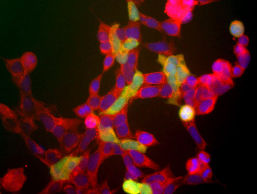 Immunolabeling of HEK 293 cells labeled with anti-neuron specific enolase antibody (cat. 1520-NSE, red, 1:500) and anti-UCHL1 antibody (cat. 2060-UCHL1, green, 1:500).