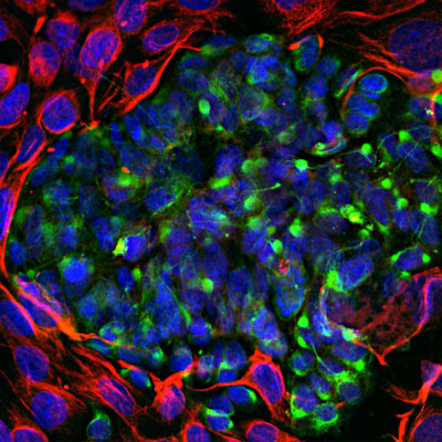 Immunoflourescence of mixed fibroblasts and PC12 cells labeled with anti-peripherin (cat. 1631-PER, green, 1:5000) and anti-vimentin (red). The blue is DAPI staining nuclear DNA. Peripherin is labeled in only the PC12 cells cytoplasmic filaments and vimentin is only labeled in the fibroblasts intermediate filaments where peripherin is not present.