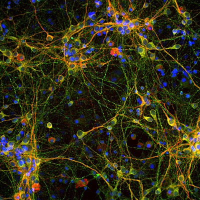 Immunostaining of cultured E20 rat cortical neurons and glia stained with anti-TAU antibody (cat. 1998-TAU, green, 1:2000) and anti-MAP2 (red). The blue is DAPI staining nuclear DNA. Anti-TAU labels perikarya, dendrites, axons of neurons while anti-MAP2 only labels dendrites and perikarya of neurons. Where they overlap they appear orange-yellow. 