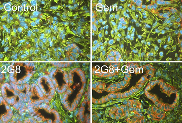 Immunostaining of tumors and precursor PanIN lesions from 4 week old LSL-KrasG12D; Cdkn2alox/lox; p48Cre (KIC) mice that were treated with 2G8 and/or gemcitabine, Gem. (Anti-Vimentin, cat. 2105-VIM, green; Anti-E-cadherin, red). Photo courtesy of Rolf Brekken, University of Texas Southwestern. CC-BY-4.0