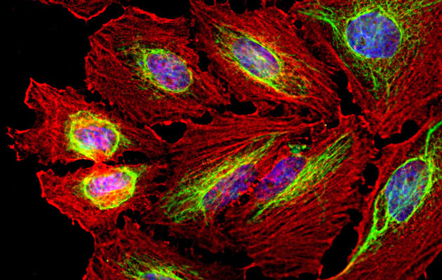 Immunostaining of HeLa cells labelled with anti-vimentin antibody (cat.2105-VIM, 1:10,000, green), anti-actin (red), and DAPI (blue) labelling of nuclear DNA. The vimentin antibody labels the intermediate filament network while the actin antibody labels the submembranous cytoskeleton, stress fibers, and bundles of actin associated with cell adhesion sites.