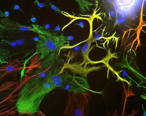 Immunostaining of mixed neuron/glial cultures stained with anti-Vimentin antibody (cat. 2105-VIM, 1:500, green) and anti-GFAP antibody (cat. 620-GFAP, 1:1000, red). Vimentin is expressed alone in fibroblastic and endothelial cells, which are the flattened cells in the middle of the image which appear green. Astrocytes may express primarily GFAP, or GFAP and vimentin, and so appear red (GFAP only) or golden yellow (GFAP and Vimentin).