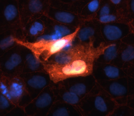 Immunofluorescence of transfected COS-7 cells specifically labeling positive beta Catenin cells using our anti-beta Catenin antibody (1:200, red) and anti-FLAG antibody (green). The yellow color results from the overlap of cells labeled with both antibodies. DNA is labeled with DAPI (blue).