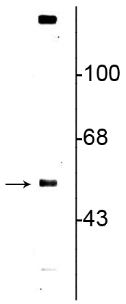 Western blot of rat striatal lysate showing specific immunolabeling of the ~57 kDa VMAT2 protein. 