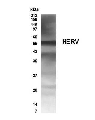 Western Blot of human placenta lysate showing specific immunolabeling of HERV.