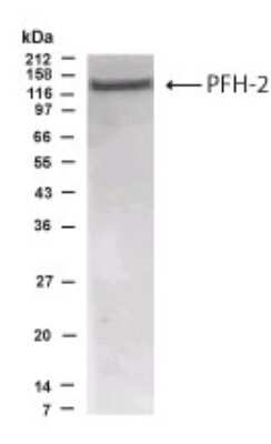 Western Blot of placenta lysate showing specific immunolabeling of PHF2.