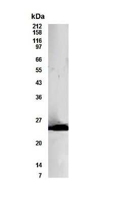 Western Blot of transfected 293 cell lysate showing specific immunolabeling of Bcl10. 