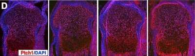 Immunohistochemistry showing specific staining of PTCH1 and increased protein levels throughout the growth plate in Smad2 and Smad3 mutants, particularly in the resting zone. All images are P0 proximal tibias. Image from the following publication (http://dx.plos.org/10.1371/journal.pgen.1006352) licensed under a CC-BY license.