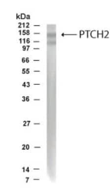 Western Blot of human fetal brain lysate showing specific immunolabeling of PTCH2. 