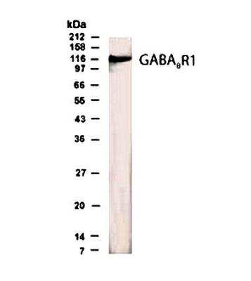 Western Blot of brain lysate showing specific immunolabeling of GABA-B R1.