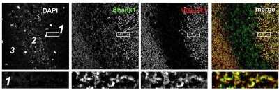 Immunohistochemistry of retinal tissue showing specific staining of Shank at 1:800 dilution. Images are 2048 X 2048, 12 bit, collected with a 40X water objective, 10 stacks 0.55 um per stack.