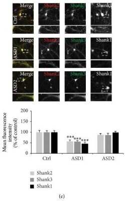 Immunocytochemistry of hippocampal neurons DIV 14 grown under control, ASD1, and ASD2 conditions. The fluorescence intensity of Shank positive puncta was measured using antibodies specific for Shank1, Shank2, and Shank3. Exemplary images (upper panel) and quantification of average puncta signal intensity of 10 cells per condition (lower panel). Merged images show additional DAPI staining of the nucleus. Neurons grown under ASD1 conditions show a significant decrease of synaptic Shank proteins, while neurons