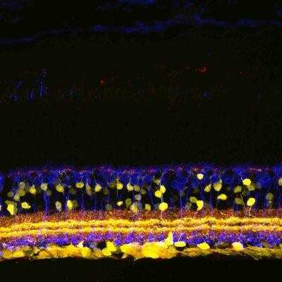 Immunohistochemistry of mouse retinal sections showing specific staining of SHANK1.