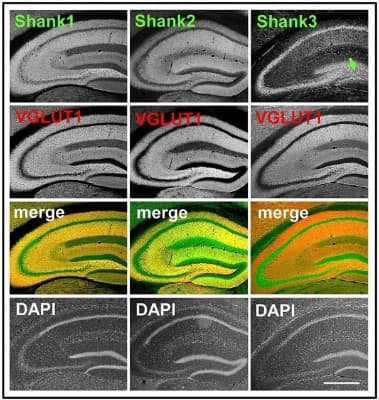 Immunohistochemistry showing synaptic distribution of Shank1/2 and somato-synaptic distribution of Shank3 in the mouse hippocampus, codistribution with VGLUT1, no codistribution with VGLUT2. 5x magnification of hippocampus. Immunofluorescence staining of coronal sections from wild-type mice probed with Shank1-3 (white; green in merge) and VGLUT1 (white; red in merge) antibodies; green arrow points toward the intragranular mossy fibers where there is a prominent synaptic stain of Shank3; scale bar =300 um. I