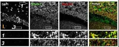 Immunohistochemistry showing  colocalization of Shank puncta with VGLUT1 puncta in the intragranular mossy fibers and the stratum moleculare of the dentate gyrus. Confocal immunofluorescence stainings of coronal sections from wild-type mice probed with the Shank1 (white; green in merge) and VGLUT1 (white; red in merge) antibodies. The upper rows (large squares) show the enlarged region (3 = SM; 2 = SG; 1 = PL; scale bar = 100 um), the bottom rows (small rectangles) show further enlargements (indicated in up