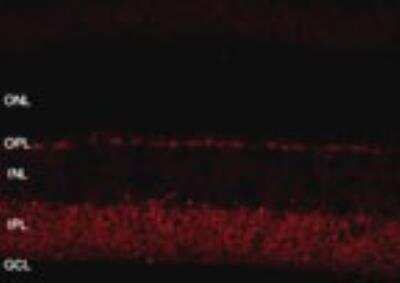 Immunohistochemistry of retinal tissue showing specific staining of Shank at 1:800 dilution. Images are 2048 X 2048, 12 bit, collected with a 40X water objective, 10 stacks 0.55 um per stack.