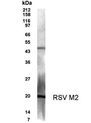 Western Blot of infected Hep-2 cell lysate showing specific immunolabeling of Respiratory Syncytial Virus M2-1 Protein. 