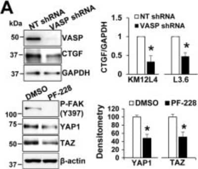 Western Blot: Upper, 3D cancer spheroids were harvested for WB for CTGF. VASP knockdown reduced CTGF protein levels in KM12L4 and L3.6 cells. Lower, cells on Matrigel were treated with PF-228 (3uM) and collected for WB. PF-228 reduced YAP1/TAZ protein levels. Samples derived from the same experiment and gels/blots were processed in parallel. Image  from the following publication (//www.nature.com/articles/s41698-017-0045-7) licensed under a CC-BY license.