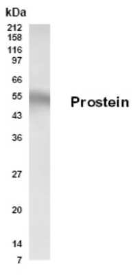 Western Blot of metastatic adenocarcinoma LNCaP.FGC cell lysate showing specific immunolabeling of Prostein.