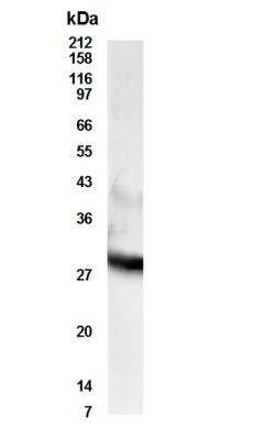 Western Blot of androgen stimulated metastatic adenocarcinoma LNCaP.FGC cells showing specific immunolabeling of RDH11. 