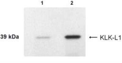 Western Blot of endometrial cancer cell lines RL95-2 (lane 1) and KLE (lane 2) showing specific immunolabeling of KLK-L1/KLK4.