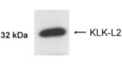 Western Blot of BT-474 cell lysate showing specific immunolabeling of Kallikrein 5. 