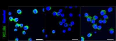 Immunocytochemistry of mouse BV2 microglia cells treated with DMSO, DMSO+lipopolysaccharide, SMSO+SP600125 (a JNK inhibitor), showing specific staining of RELM alpha in green and nuclear staining in blue. 