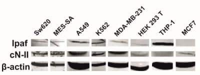 Western Blot showing specific immunolabeling of cN-II and Ipaf (CARD12) protein expression in different human cell lines. Image from the following publication (https://dx.plos.org/10.1371/journal.pone.0121525) licensed under a CC-BY license.