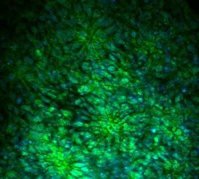 Immunocytochemistry of human neural rosettes showing specific staining of Musashi-1 in green. Nuclei are counterstained blue (DAPI). Cells were fixed with 4 percent PFA. No antigen retrieval was done.