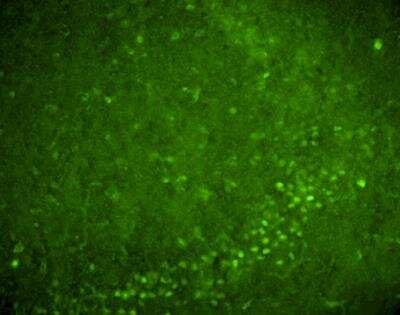 Immunohistochemistry of adult rat brain hippocampus showing specific staining of Nurr1.  Tissue was fixed in paraformaldehyde and cut into 20 micron sections.