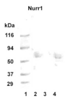 Western Blot of 20 ug of human hippocampus tissue lysate (lanes 2 and 4) showing specific immunolabeling of Nurr1. Peptide absorption control lane 3.