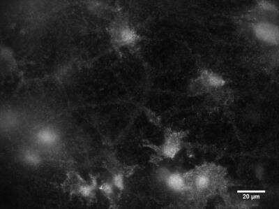 Immunocytochemistry of primary rat cortical neurons showing specific staining of mGluR1.