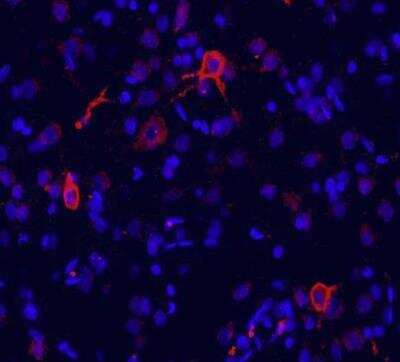 Immunohistochemistry of rat brain frozen sections (cingulate cortex) showing specific staining  of mGluR1 in red.  DAPI was used to counterstain cell nuclei (blue). 