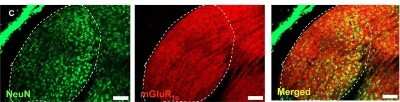 Immunohistochemistry of mGluR and 5-HTR subtypes in dLGN of Galpha11-/- mice. mGluR1alpha-specific antibodies caused strong staining as in the dLGN of Galphaq/Galpha11-/-mice. Scale bars indicate 100 um. Image  from the following publication (http://journal.frontiersin.org/article/10.3389/fncel.2010.00132/abstract) licensed under a CC-BY license.