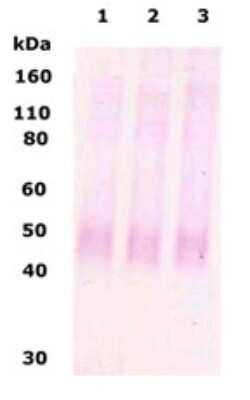 Western Blot of 10 ug of human brain lysate (lane 1), rat brain lysate (lane 2) and mouse brain lysate (lane 3) showing specific immunolabeling of MOR-1.